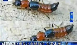 隐翅虫皮炎 隐翅虫皮炎